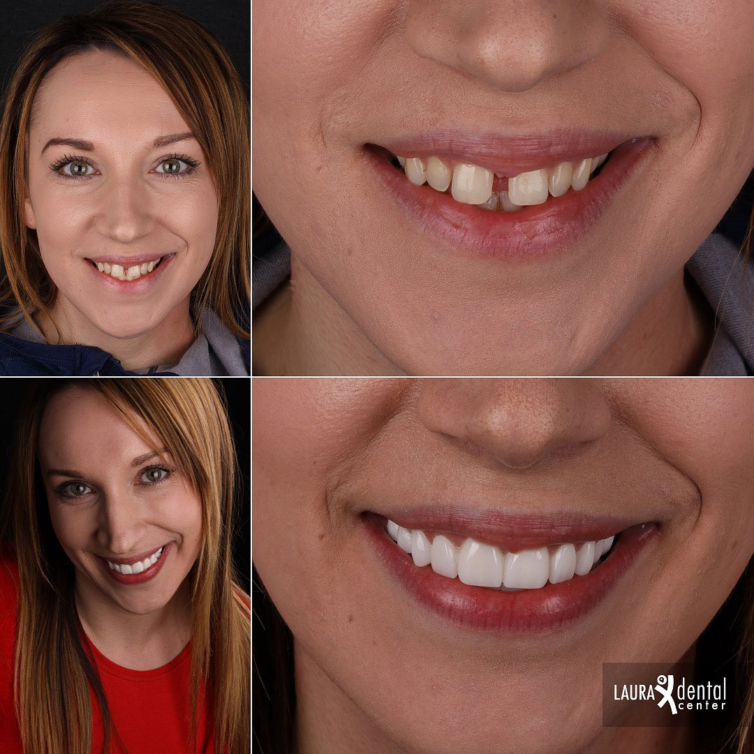 before and after dentist photo